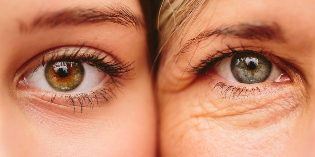 treat under eye wrinkles